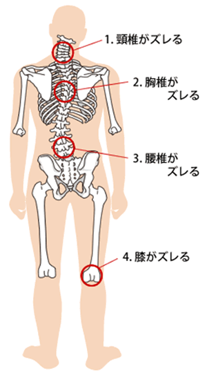 腰痛の原因
